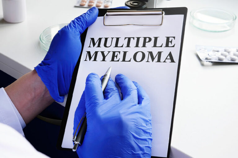 Multiple Myeloma – Symptoms, and Management Tips